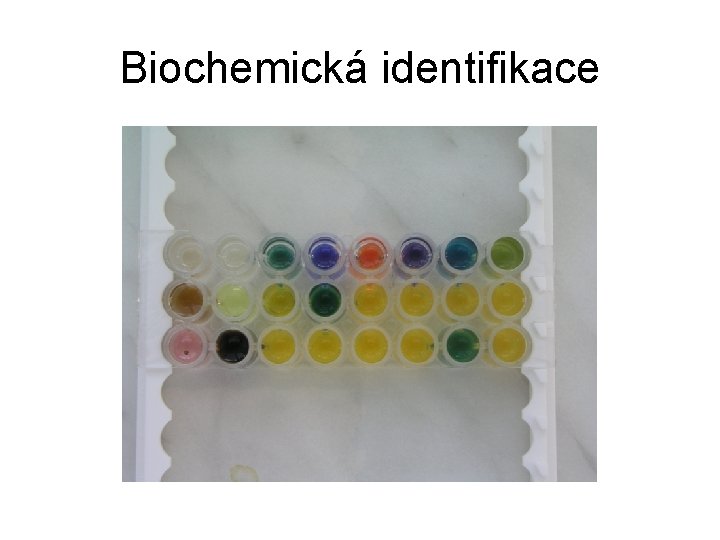 Biochemická identifikace 