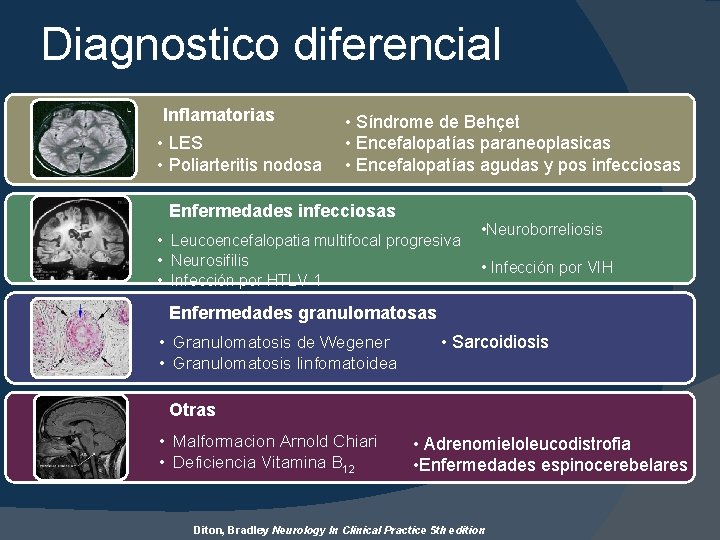 Diagnostico diferencial Inflamatorias • LES • Poliarteritis nodosa • Síndrome de Behçet • Encefalopatías