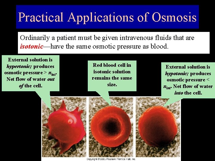 Practical Applications of Osmosis Ordinarily a patient must be given intravenous fluids that are