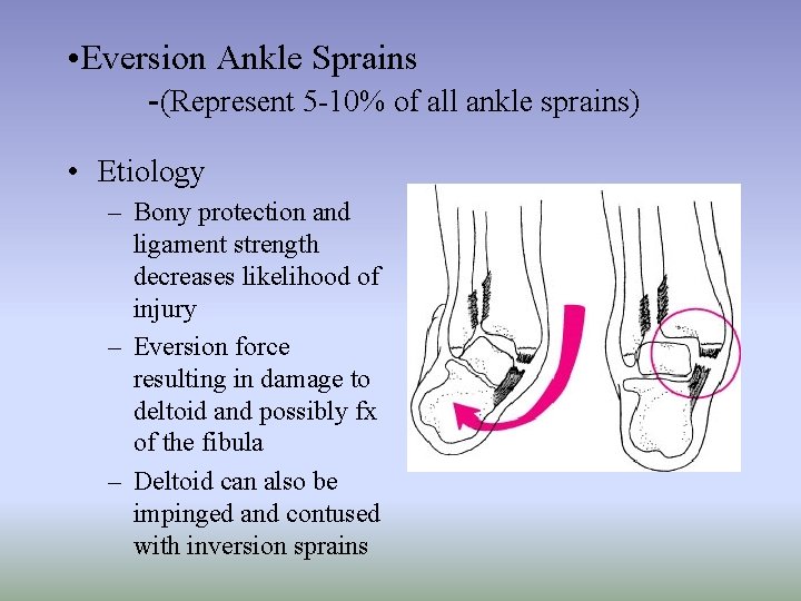  • Eversion Ankle Sprains -(Represent 5 -10% of all ankle sprains) • Etiology