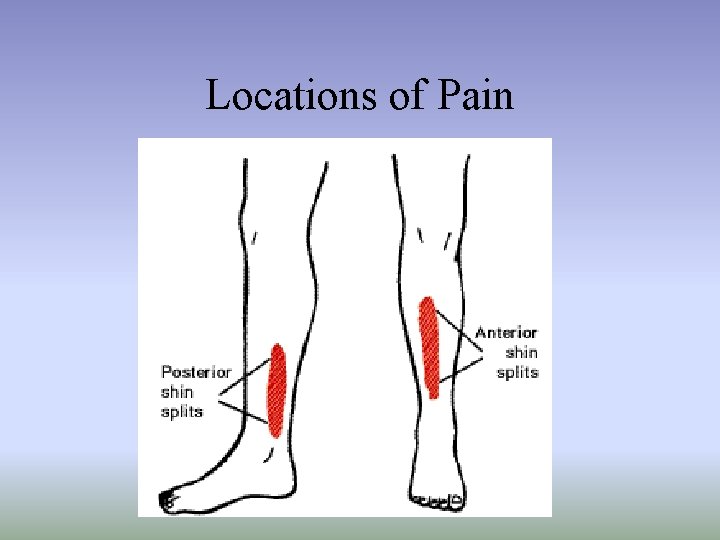 Locations of Pain 