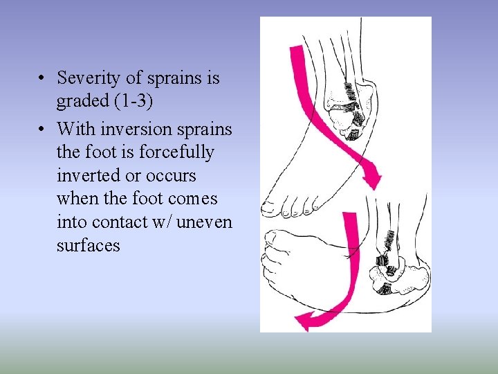  • Severity of sprains is graded (1 -3) • With inversion sprains the