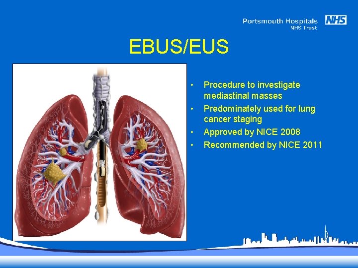 EBUS/EUS • • Procedure to investigate mediastinal masses Predominately used for lung cancer staging