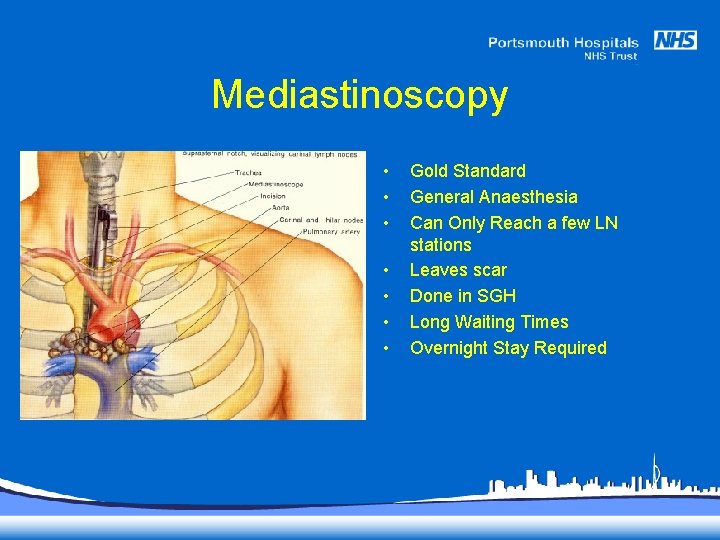 Mediastinoscopy • • Gold Standard General Anaesthesia Can Only Reach a few LN stations