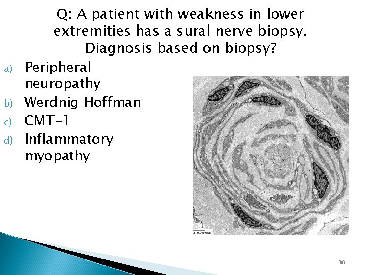 a) b) c) d) Q: A patient with weakness in lower extremities has a