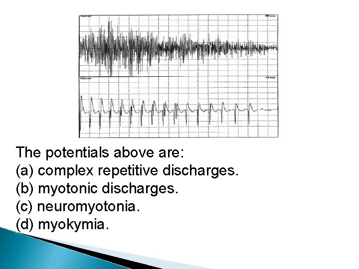 The potentials above are: (a) complex repetitive discharges. (b) myotonic discharges. (c) neuromyotonia. (d)