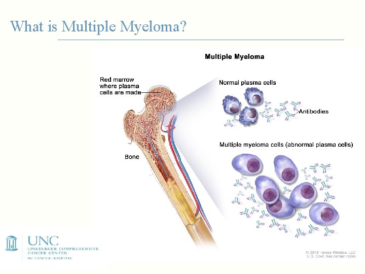 What is Multiple Myeloma? 