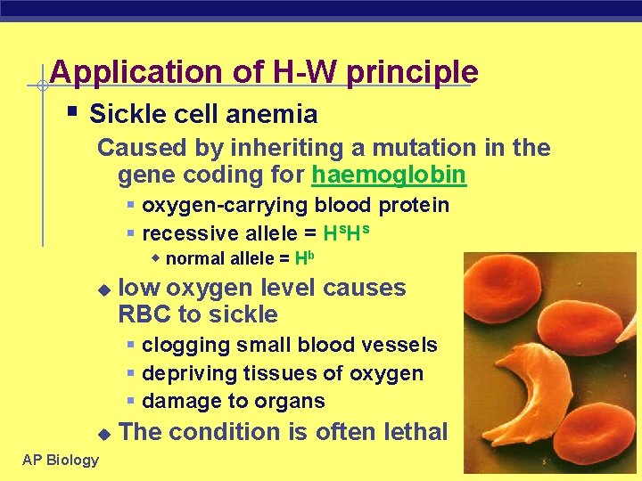 Application of H-W principle § Sickle cell anemia Caused by inheriting a mutation in