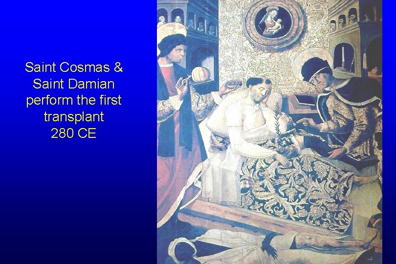 Saint Cosmas & Saint Damian perform the first transplant 280 CE 