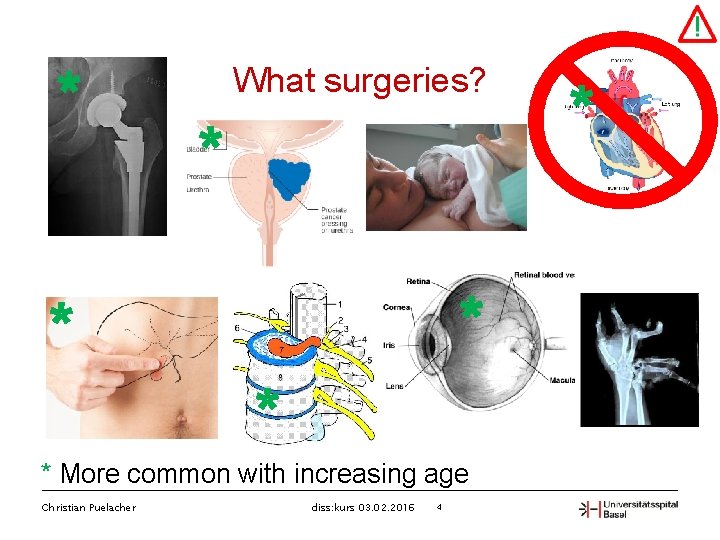 * What surgeries? * * * More common with increasing age Christian Puelacher diss: