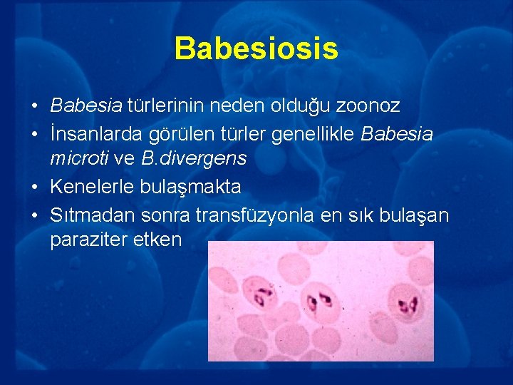 Babesiosis • Babesia türlerinin neden olduğu zoonoz • İnsanlarda görülen türler genellikle Babesia microti