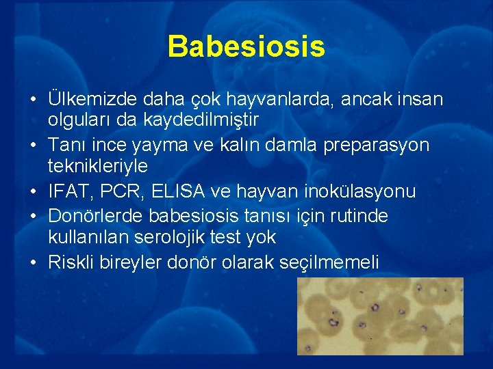 Babesiosis • Ülkemizde daha çok hayvanlarda, ancak insan olguları da kaydedilmiştir • Tanı ince