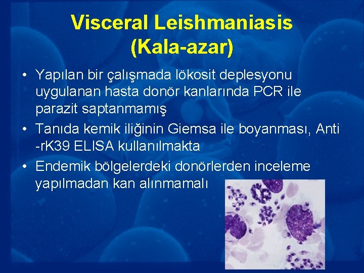 Visceral Leishmaniasis (Kala-azar) • Yapılan bir çalışmada lökosit deplesyonu uygulanan hasta donör kanlarında PCR