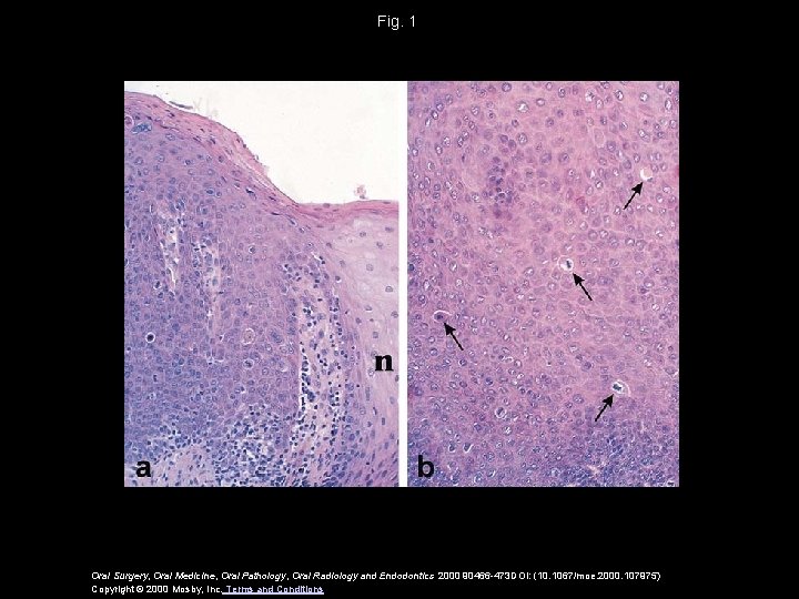 Fig. 1 Oral Surgery, Oral Medicine, Oral Pathology, Oral Radiology and Endodontics 2000 90466