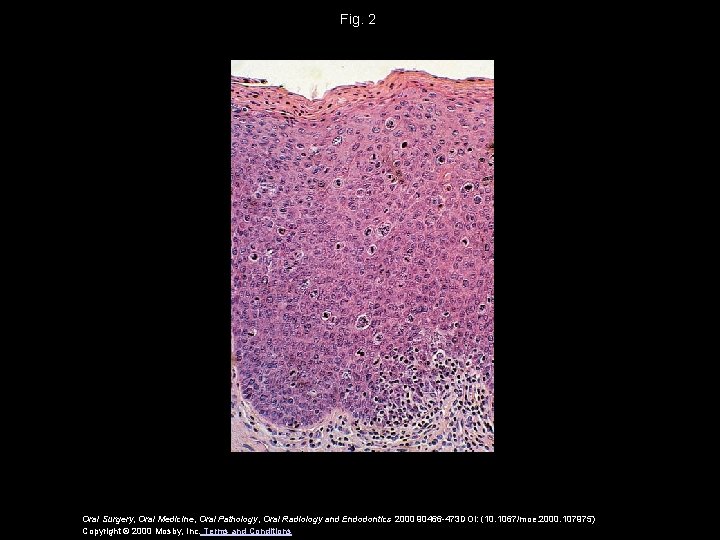 Fig. 2 Oral Surgery, Oral Medicine, Oral Pathology, Oral Radiology and Endodontics 2000 90466