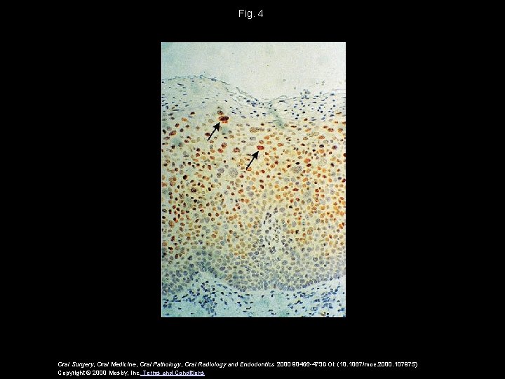 Fig. 4 Oral Surgery, Oral Medicine, Oral Pathology, Oral Radiology and Endodontics 2000 90466