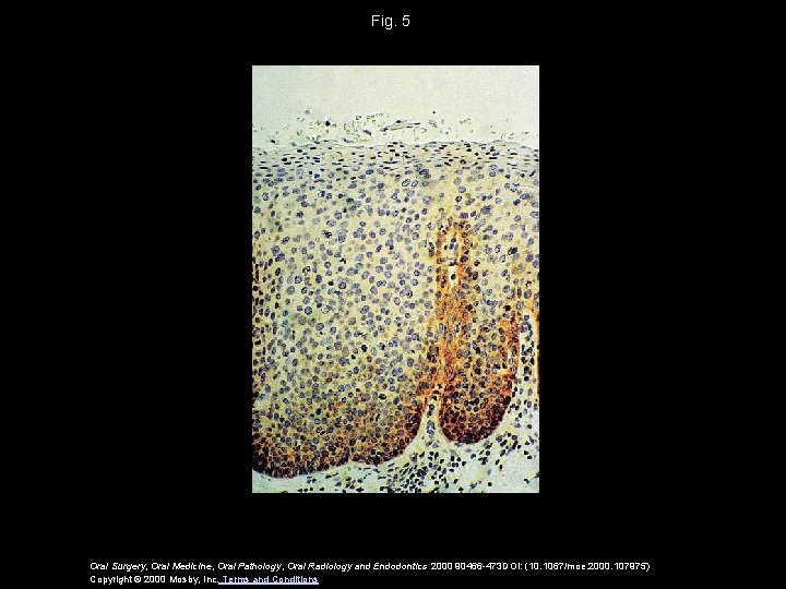 Fig. 5 Oral Surgery, Oral Medicine, Oral Pathology, Oral Radiology and Endodontics 2000 90466