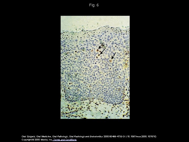 Fig. 6 Oral Surgery, Oral Medicine, Oral Pathology, Oral Radiology and Endodontics 2000 90466