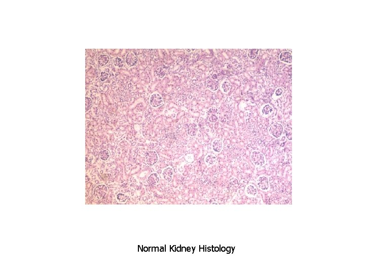 Normal Kidney Histology 