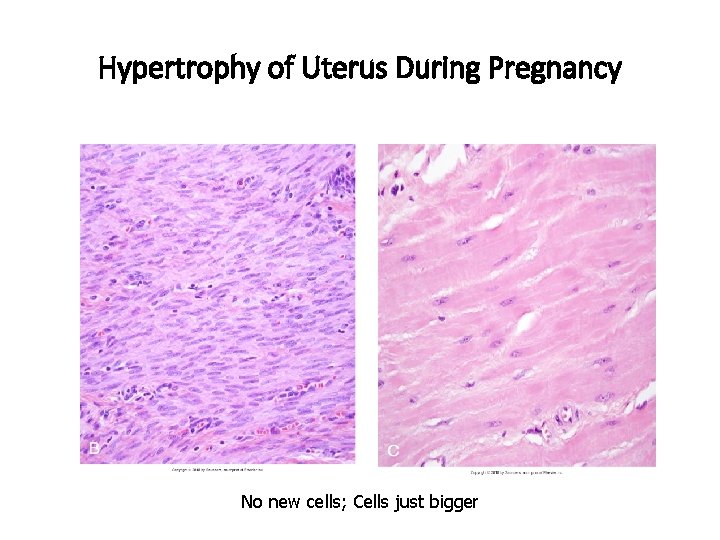 Hypertrophy of Uterus During Pregnancy No new cells; Cells just bigger 