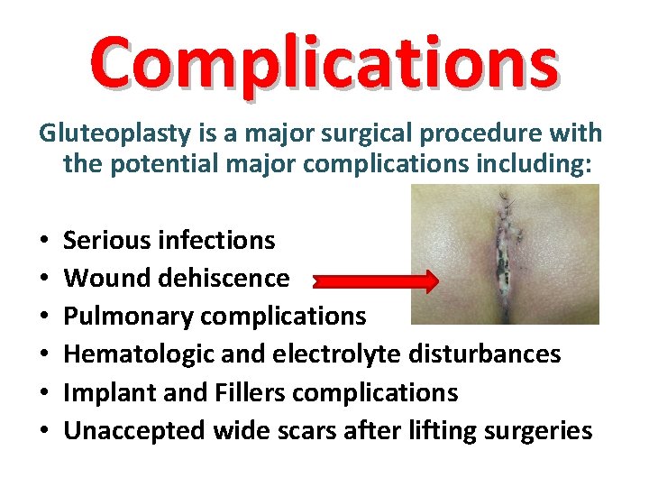 Complications Gluteoplasty is a major surgical procedure with the potential major complications including: •