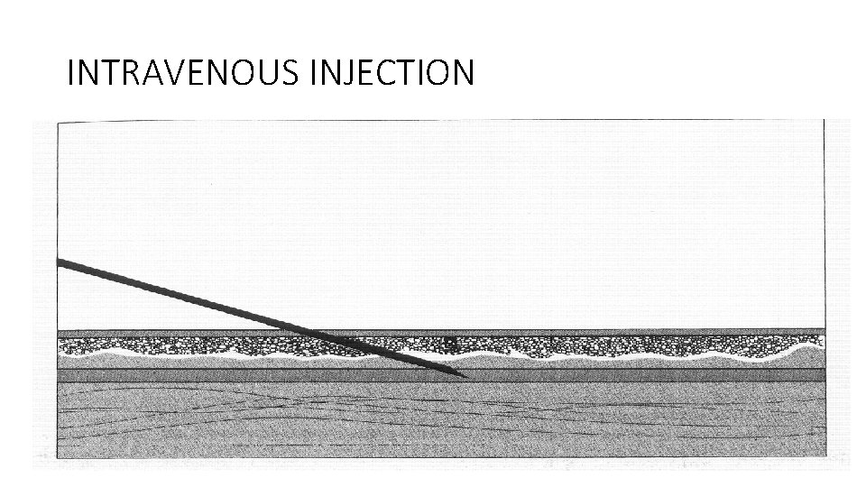 INTRAVENOUS INJECTION 