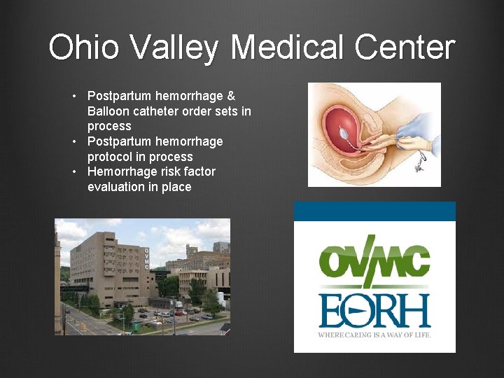 Ohio Valley Medical Center • Postpartum hemorrhage & Balloon catheter order sets in process
