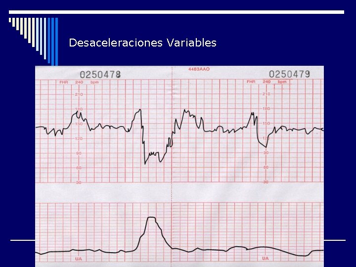 Desaceleraciones Variables 