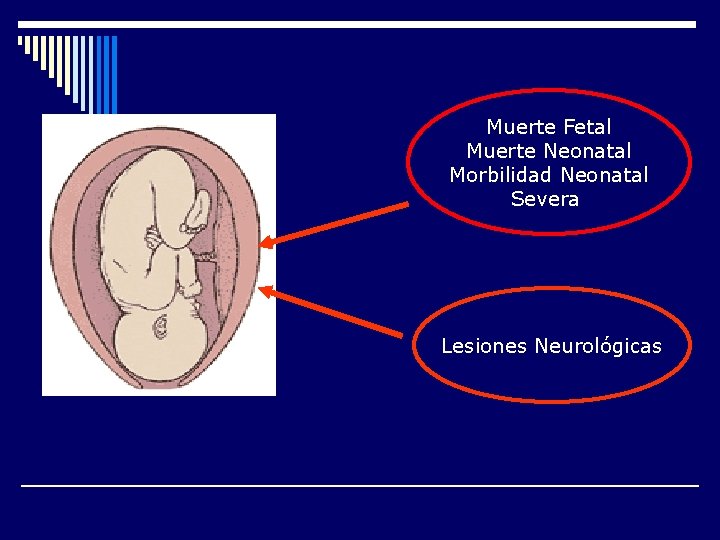 Muerte Fetal Muerte Neonatal Morbilidad Neonatal Severa Lesiones Neurológicas 