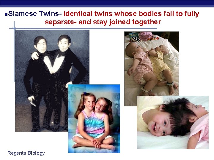  Siamese Twins- identical twins whose bodies fail to fully separate- and stay joined
