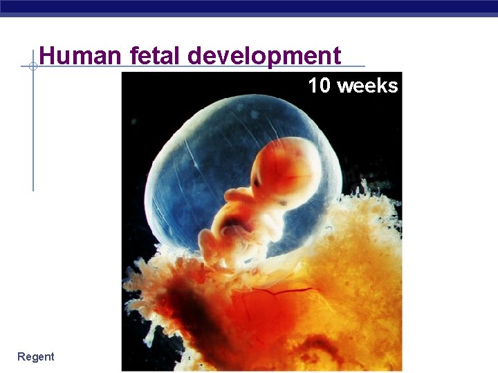 Human fetal development 10 weeks Regents Biology 