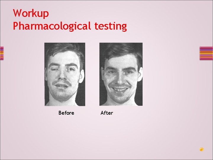 Workup Pharmacological testing Before After 