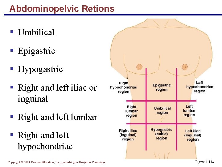 Abdominopelvic Retions § Umbilical § Epigastric § Hypogastric § Right and left iliac or