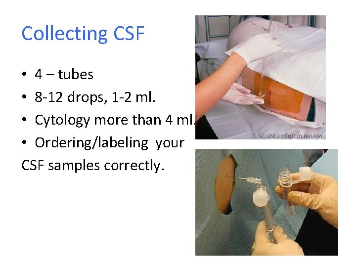 Collecting CSF • 4 – tubes • 8 -12 drops, 1 -2 ml. •