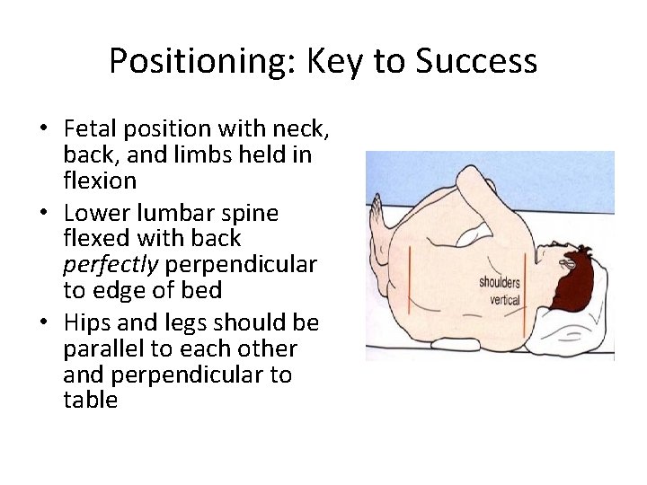 Positioning: Key to Success • Fetal position with neck, back, and limbs held in