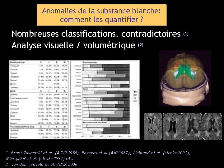 Anomalies de la substance blanche: comment les quantifier ? Nombreuses classifications, contradictoires Analyse visuelle