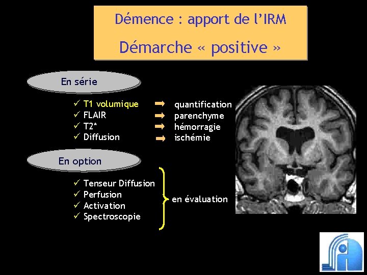 Démence : apport de l’IRM Démarche « positive » En série ü T 1