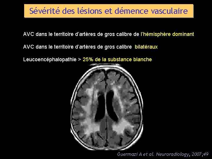 Sévérité des lésions et démence vasculaire AVC dans le territoire d’artères de gros calibre