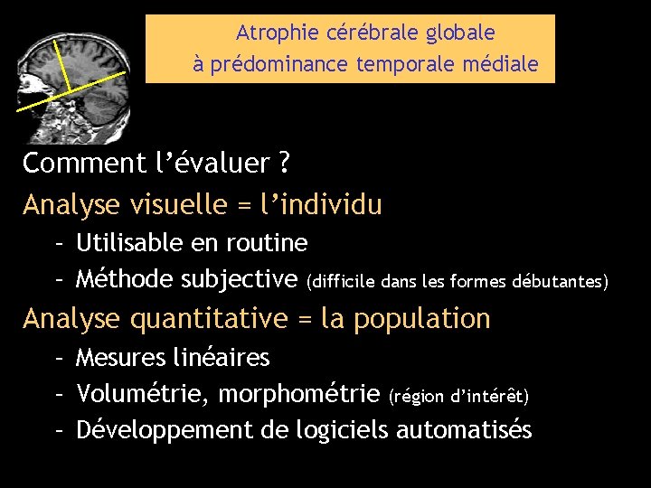 Atrophie cérébrale globale à prédominance temporale médiale Comment l’évaluer ? Analyse visuelle = l’individu