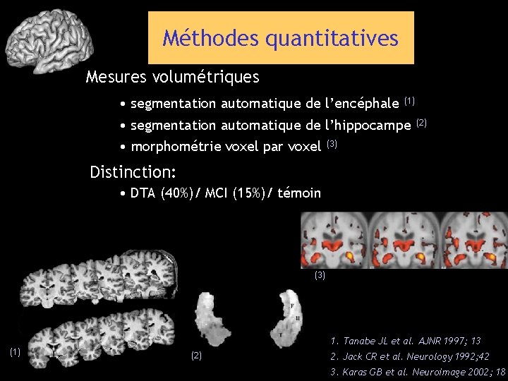 Méthodes quantitatives Mesures volumétriques • segmentation automatique de l’encéphale (1) • segmentation automatique de