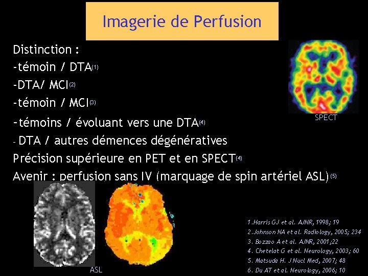 Imagerie de Perfusion Distinction : -témoin / DTA(1) -DTA/ MCI(2) -témoin / MCI(3) -témoins