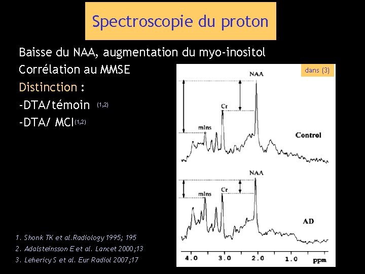 Spectroscopie du proton Baisse du NAA, augmentation du myo-inositol Corrélation au MMSE Distinction :