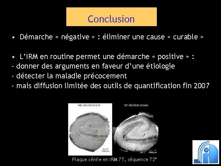 Conclusion • Démarche « négative » : éliminer une cause « curable » •