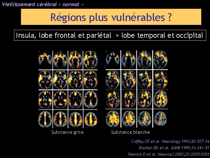 Vieillissement cérébral « normal » Régions plus vulnérables ? Insula, lobe frontal et pariétal