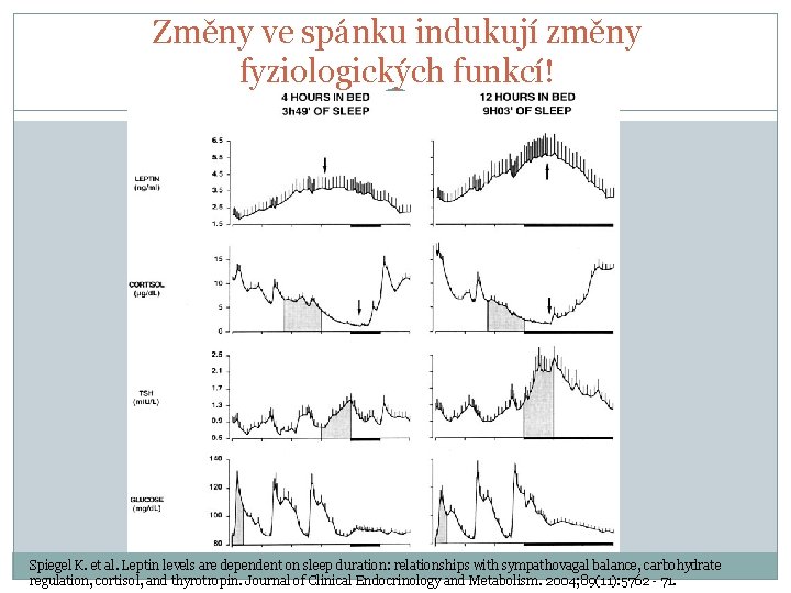 Změny ve spánku indukují změny fyziologických funkcí! Spiegel K. et al. Leptin levels are