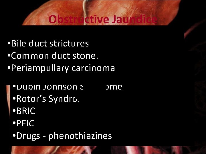 Obstructive Jaundice • Bile duct strictures Cholestasis • Intrahepatic • Common duct stone. •