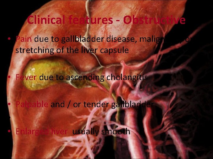 Clinical features - Obstructive • Pain due to gallbladder disease, malignancy or stretching of