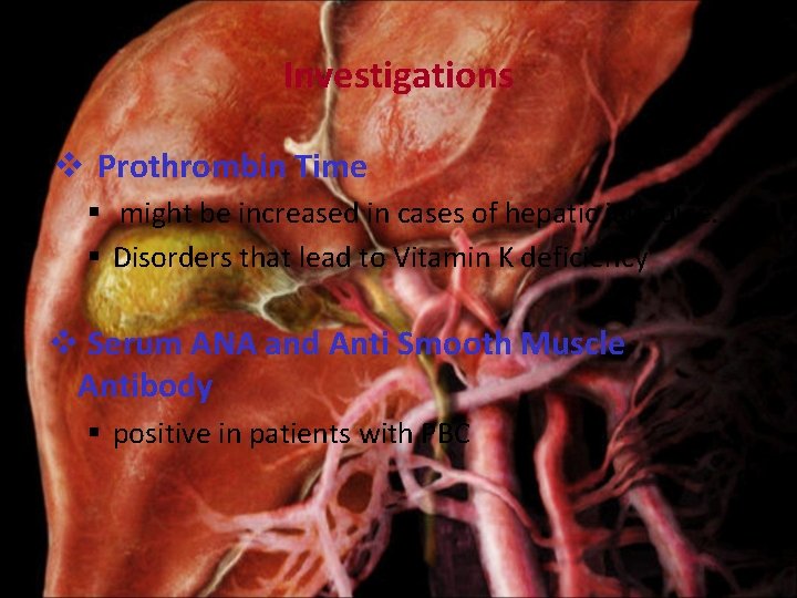 Investigations v Prothrombin Time § might be increased in cases of hepatic jaundice. §