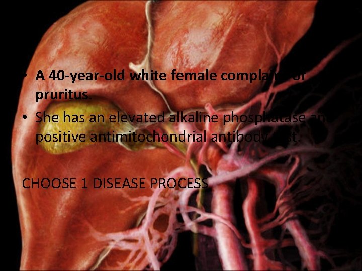 • A 40 -year-old white female complains of pruritus. • She has an