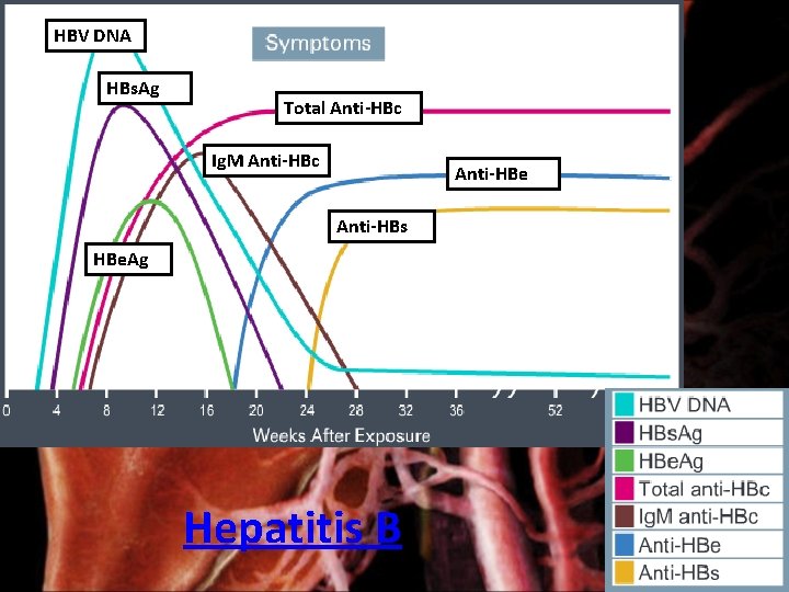 HBV DNA HBs. Ag Total Anti-HBc Ig. M Anti-HBc Anti-HBe Anti-HBs HBe. Ag Hepatitis